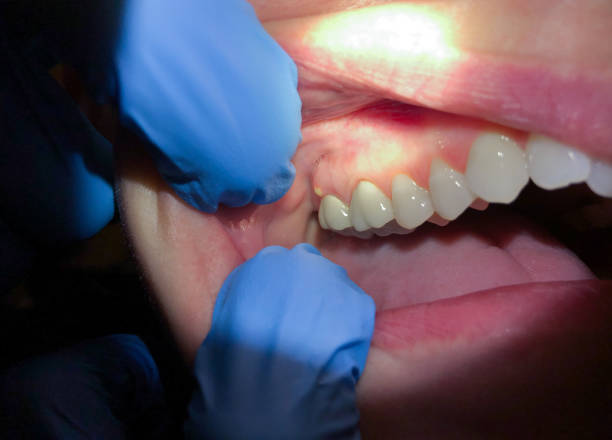 Best Broken Tooth Emergency  in St Hedwig, TX