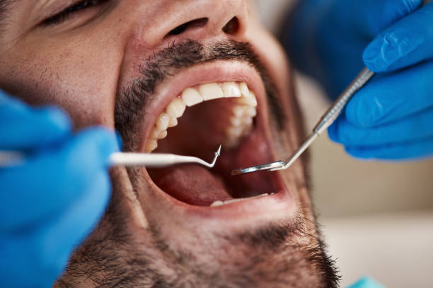 Best Emergency Gum Pain Relief  in St Hedwig, TX